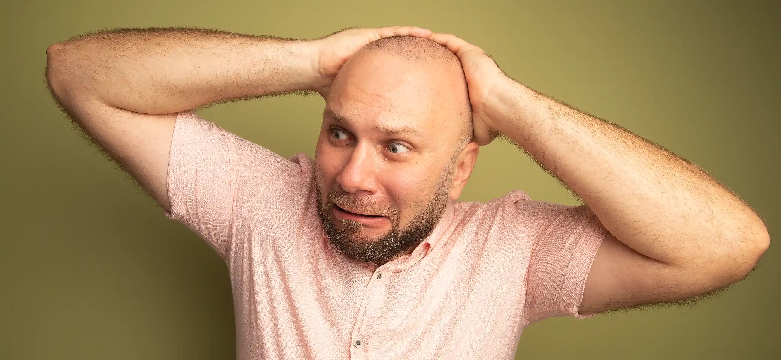 6 leading causes of baldness in men and women explained