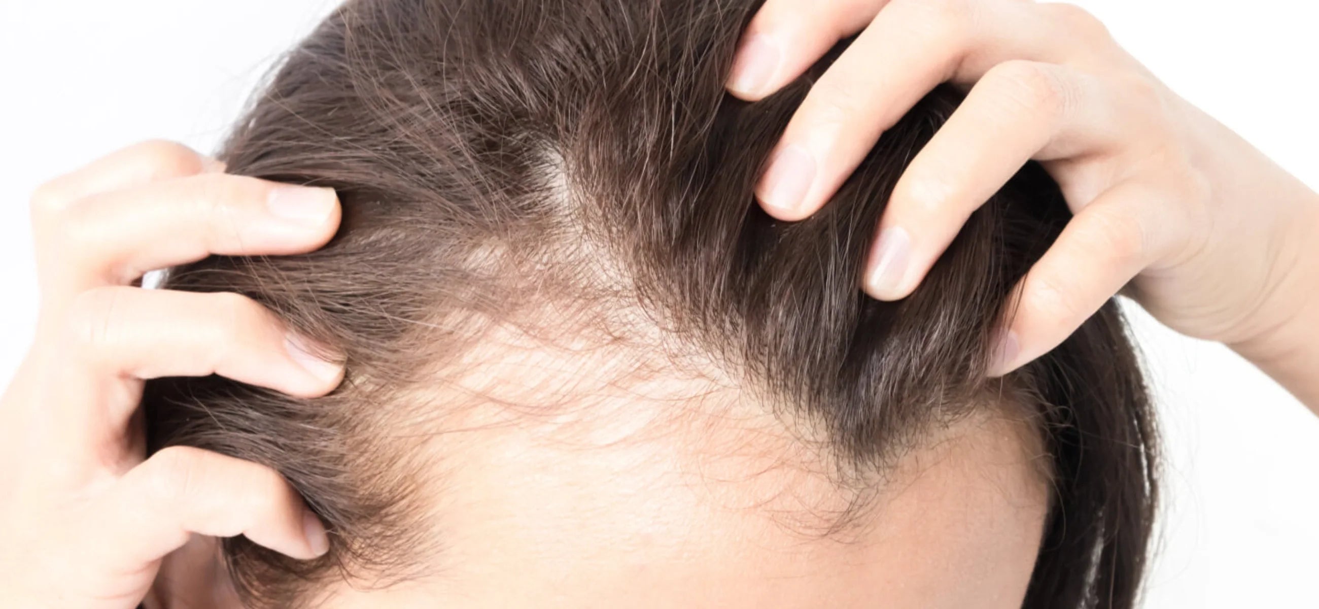 Does Ozempic cause hair loss?