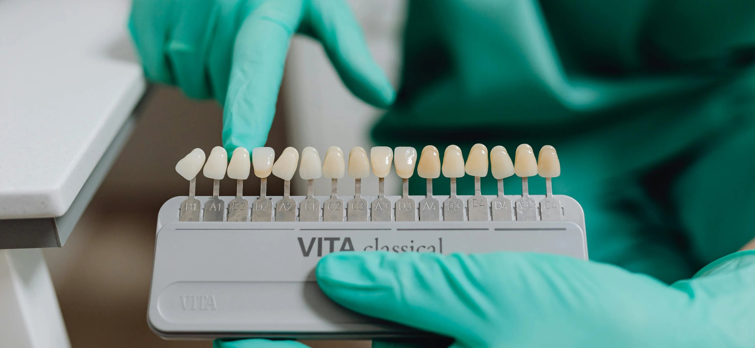 A deep dive into the five stages of tooth decay