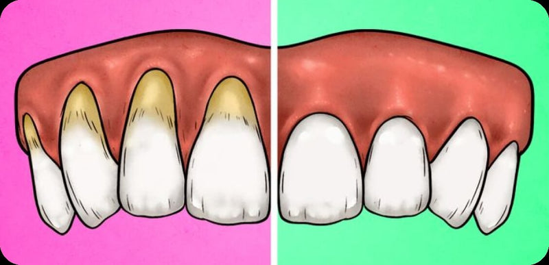 Brushing Duration